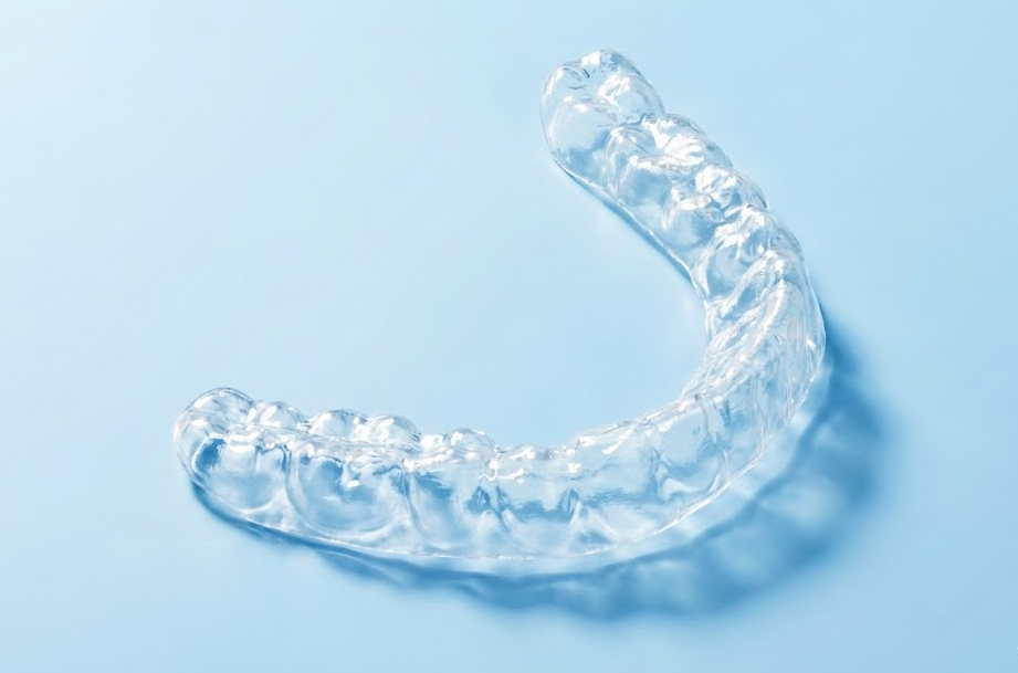 Individuelle Bleachingschiene für Oberkiefer