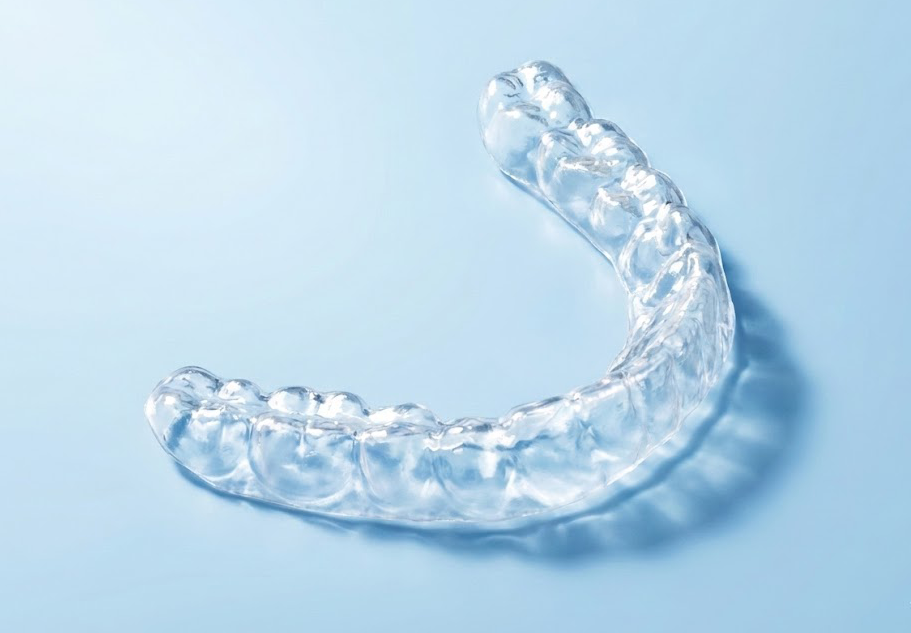 Individuelle Bleachingschiene für Unterkiefer